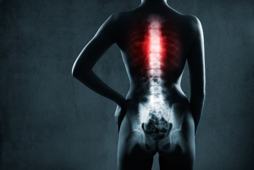 back injury lawyer New York