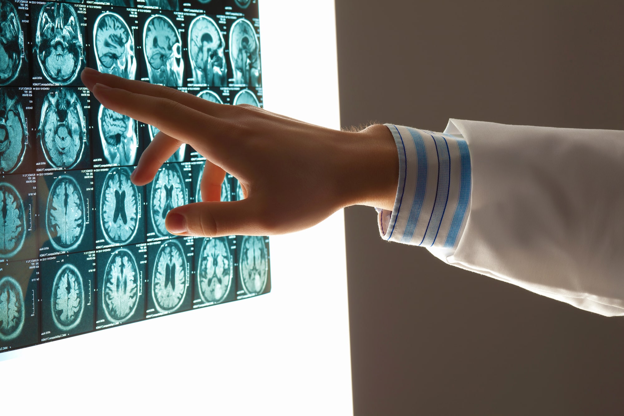 Brain Injury Lawyer in Ossining, NY